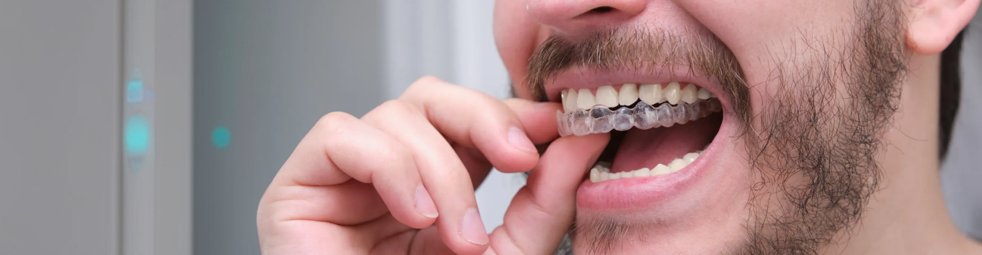 Close-up of a man inserting a clear orthodontic aligner over his teeth.